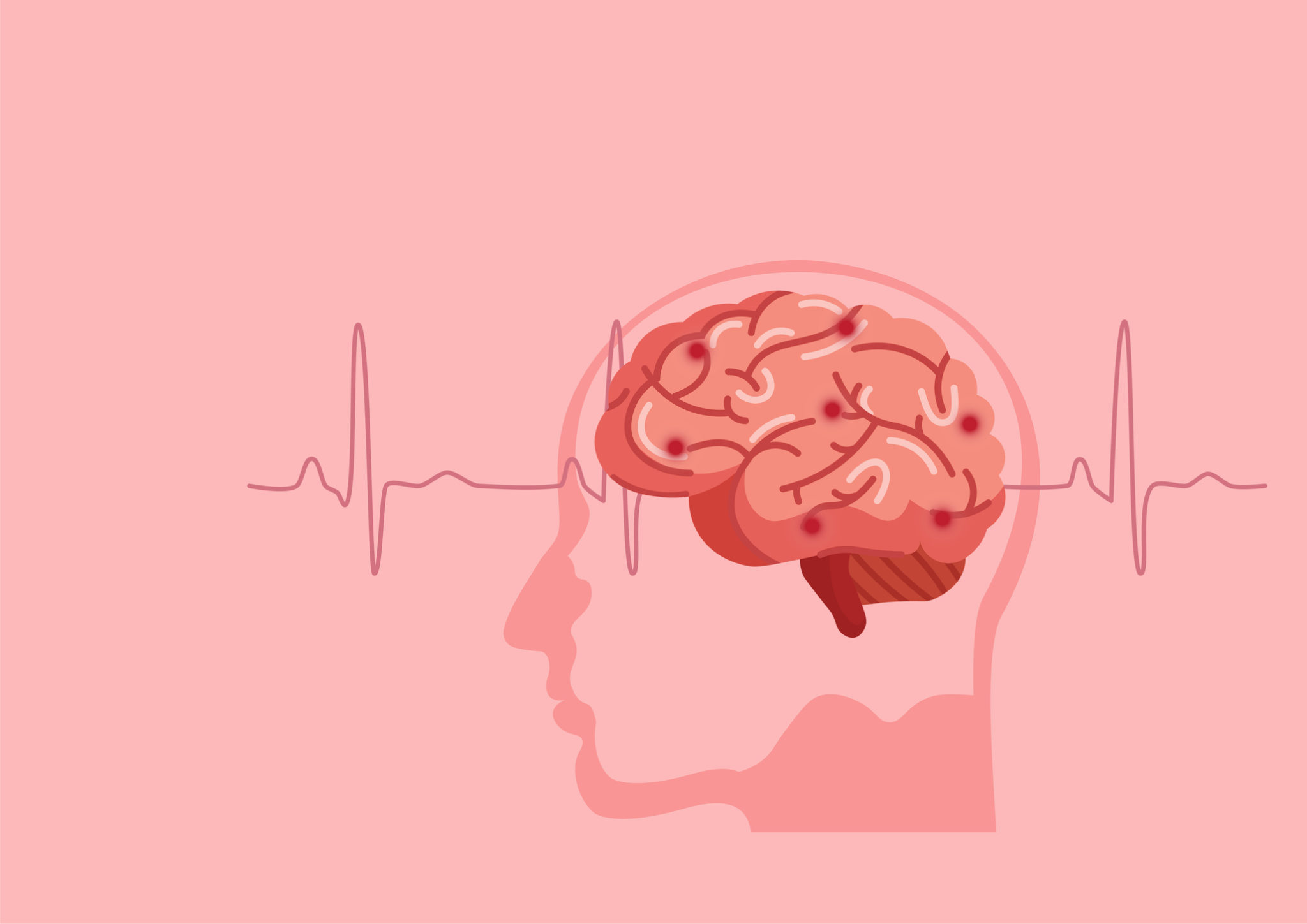 Treating Strokes