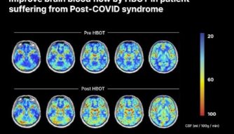 Long-covid-hbot