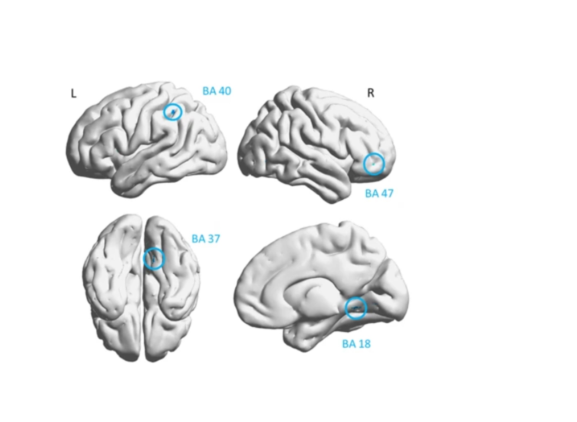 image of Groundbreaking clinical trial shows remarkable results for kids with TBI  