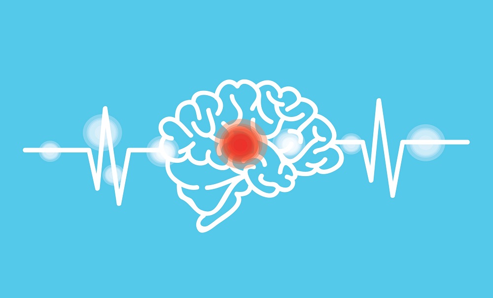 hemorrhagic stroke symptoms