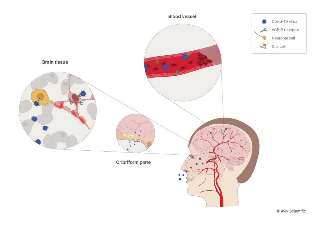 how-long-does-covid-brain-fog-last