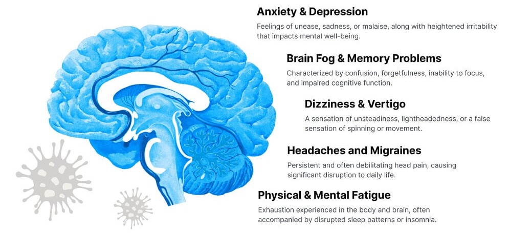 long covid symptoms